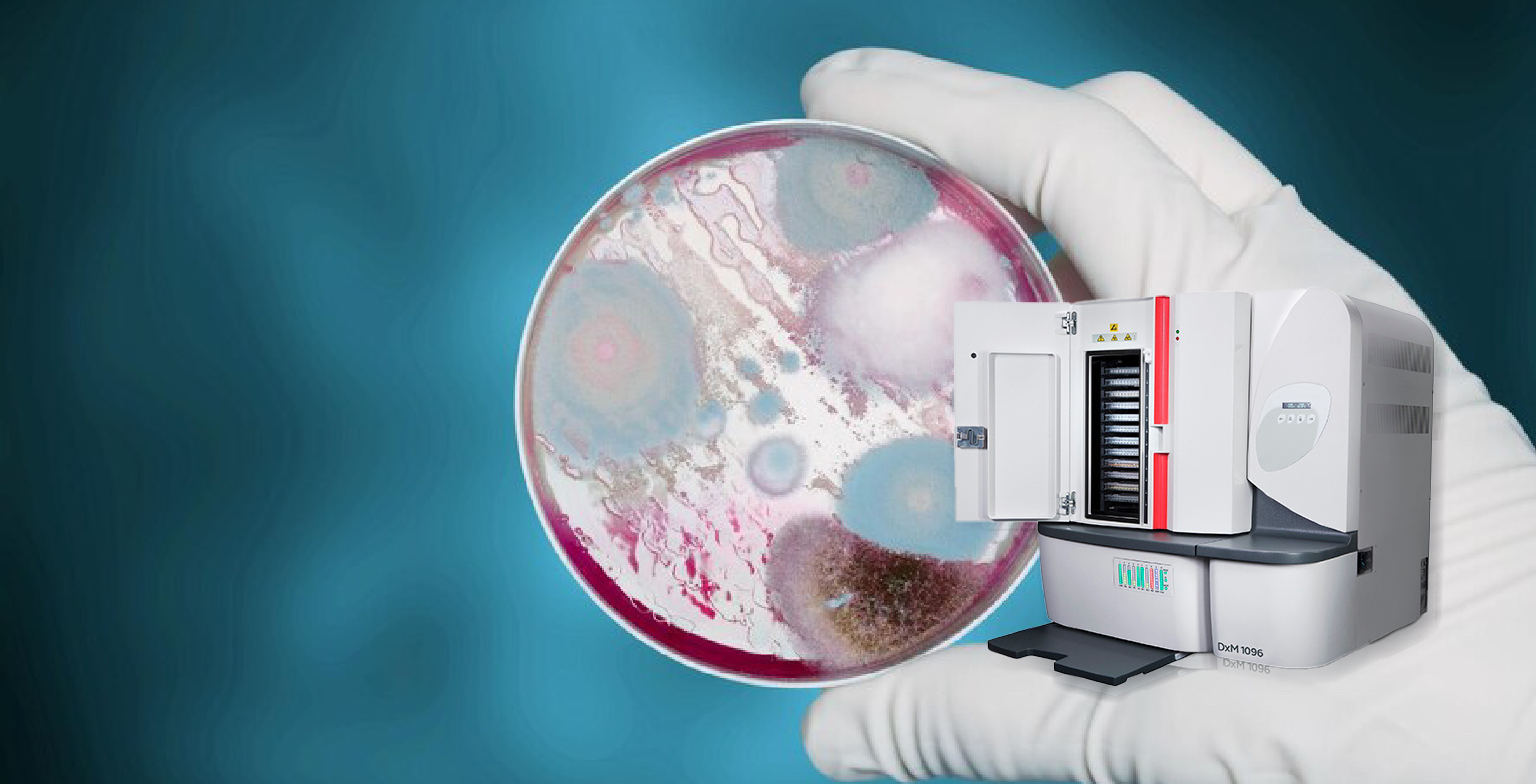 Detección precisa de resistencia antimicrobiana de los microorganismos.