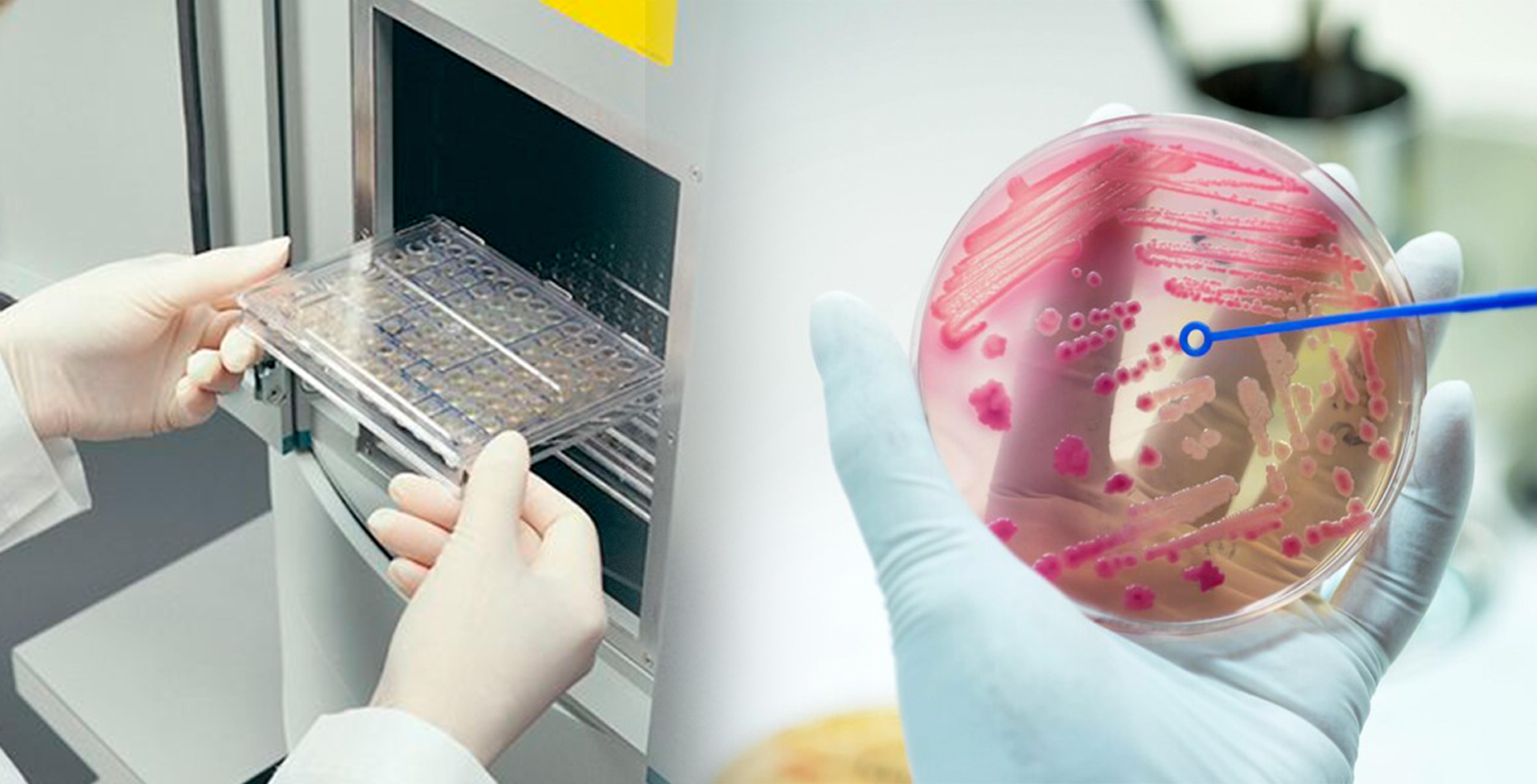 Reduce las limitaciones clínicamente significativa de cualquier sistema de ID/AST automatizado.