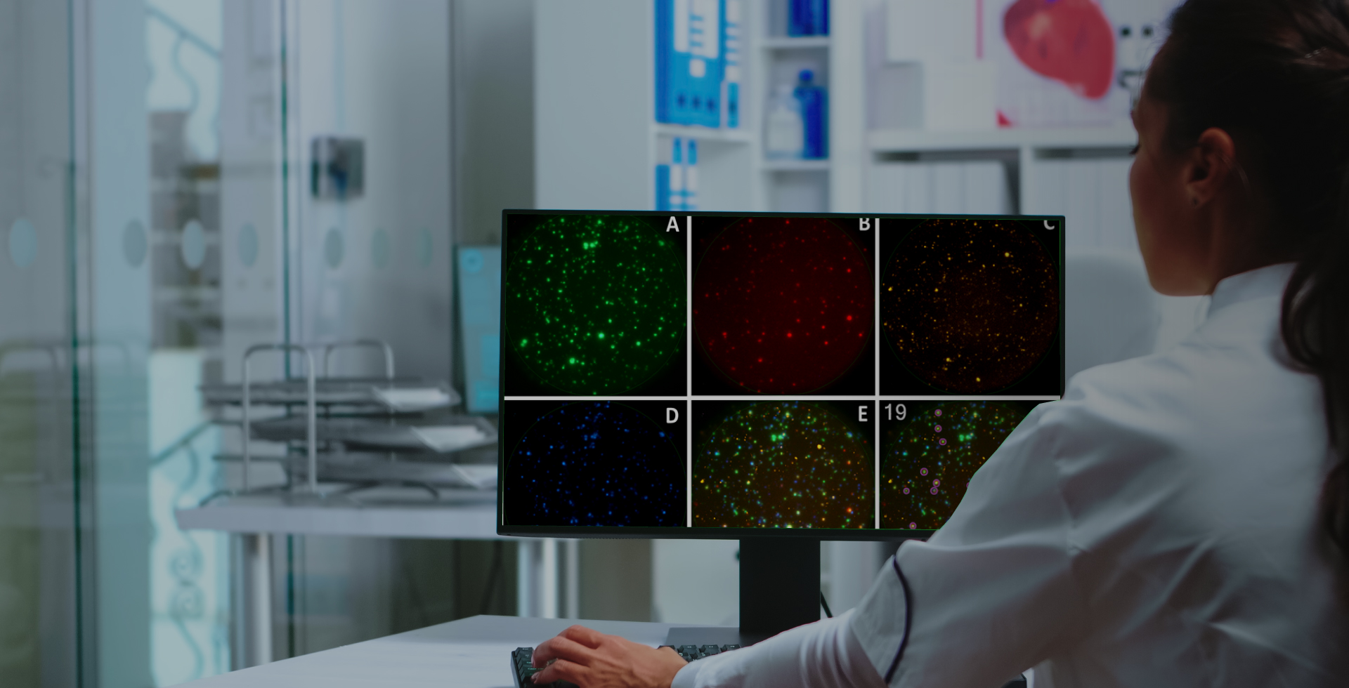 Immunospot CTL - soluciones para inmunomonitoreo celular