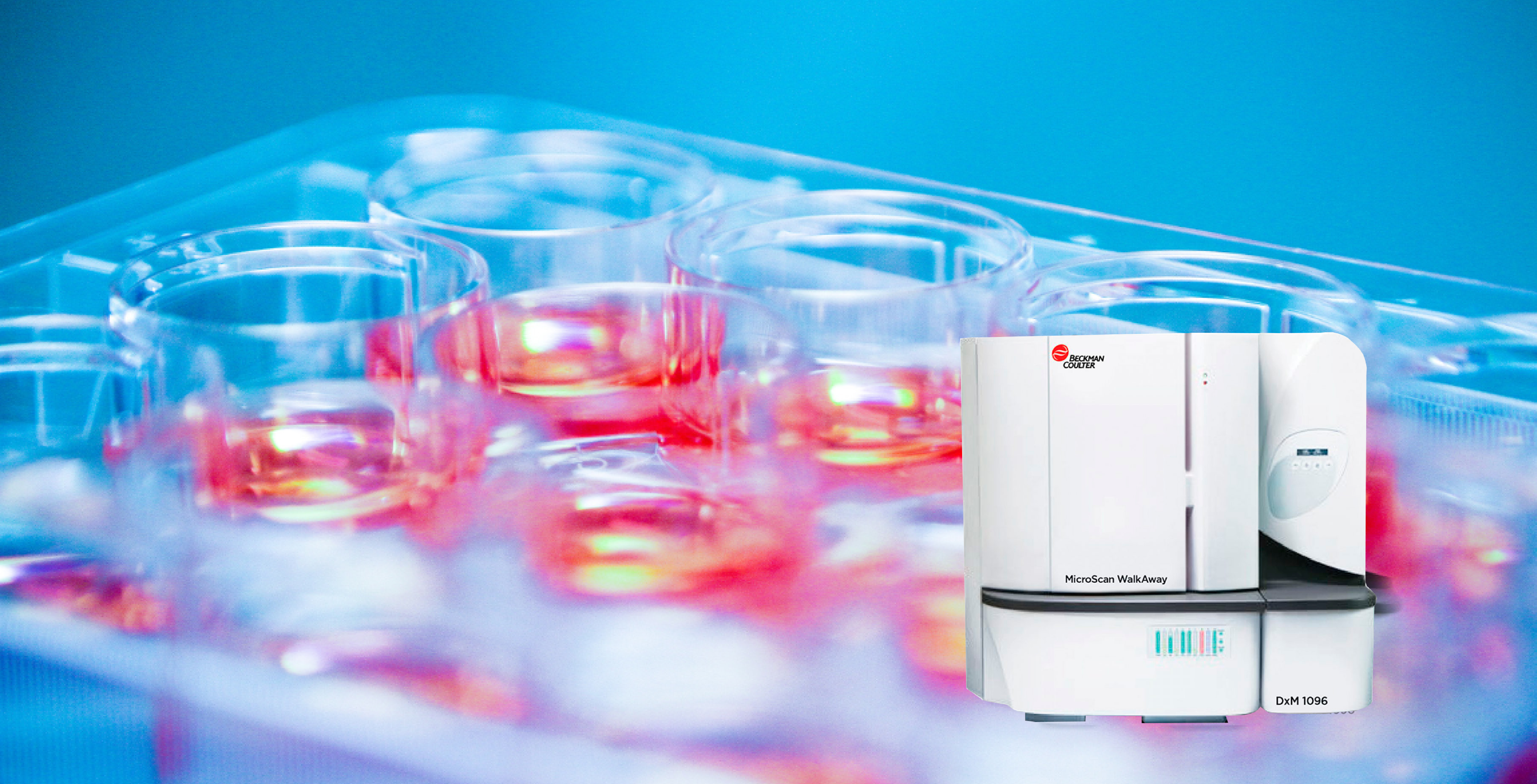 Detección del patrón inusual de susceptibilidad a ismrk en el panel de microescaneo.